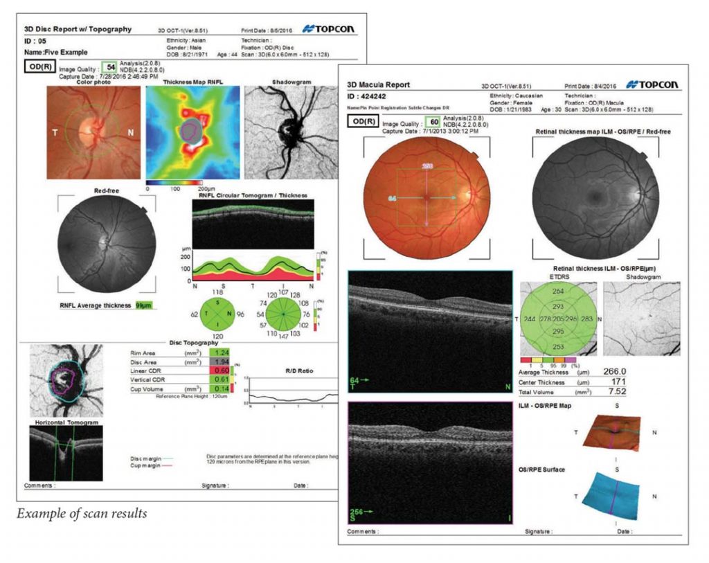 visualize optometry