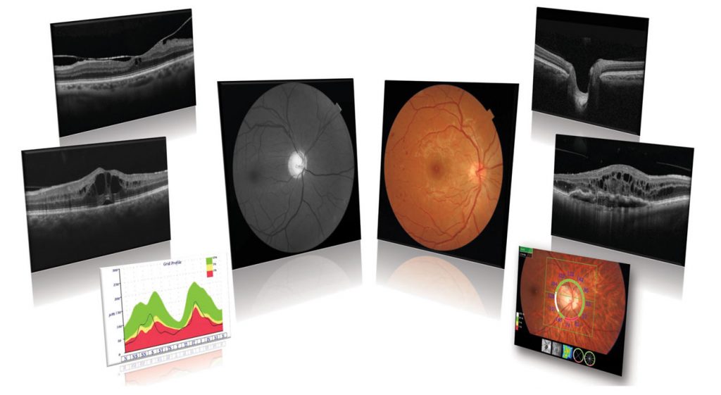 visualize optometry